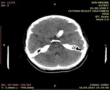 Fig. 5