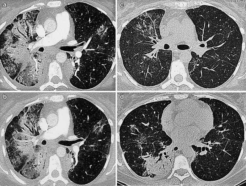 Fig. 1