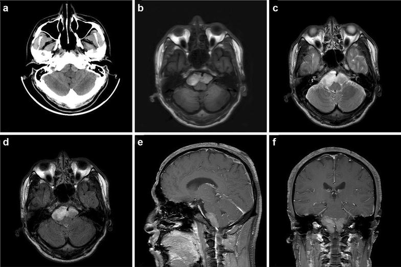 Fig. 1