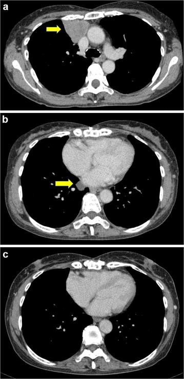 Fig. 1