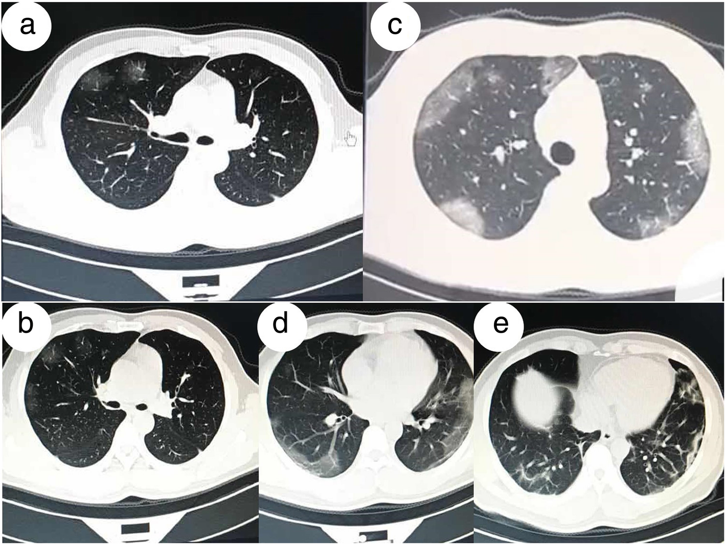 Fig. 4