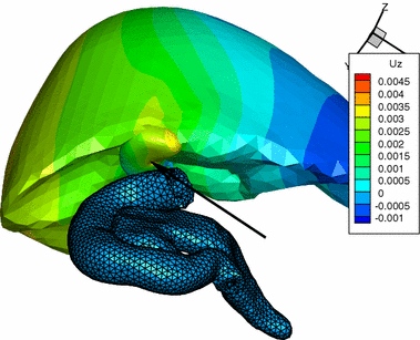 Fig. 11