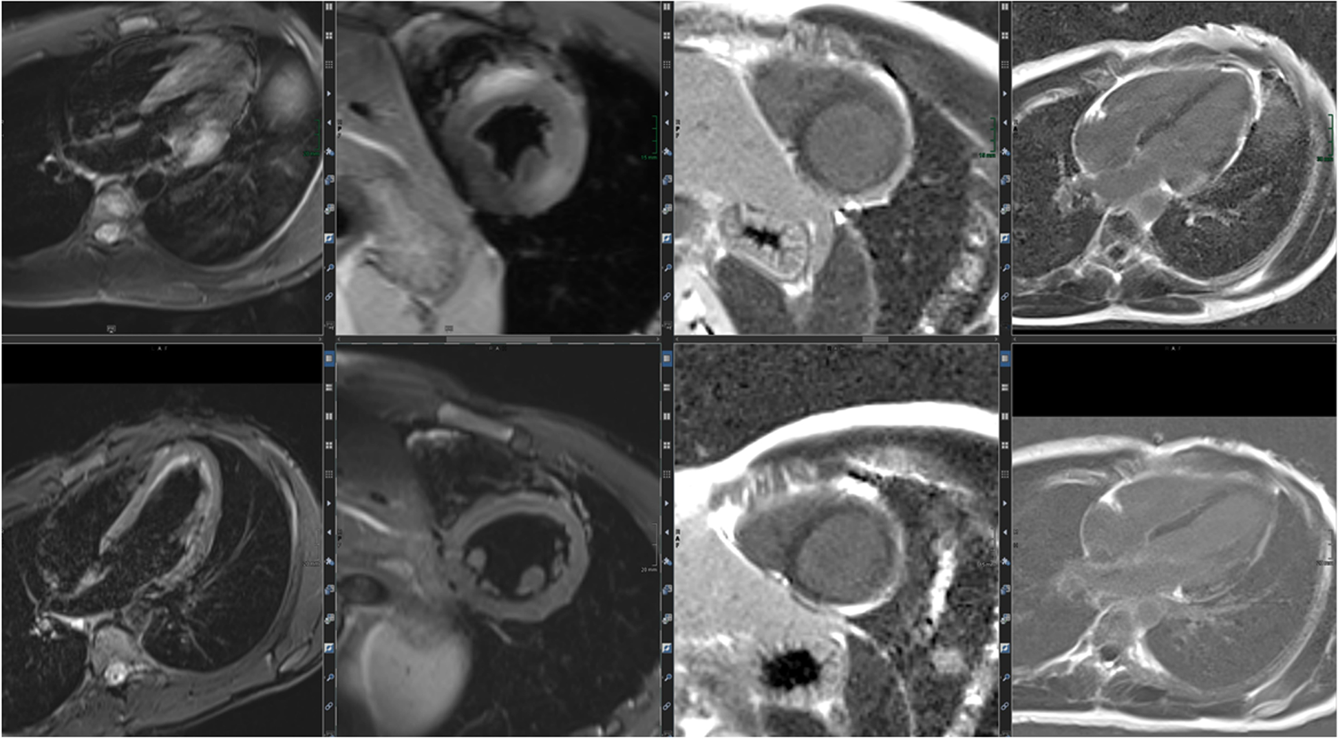 Fig. 16