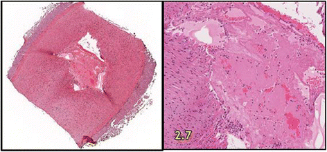 Fig. 14