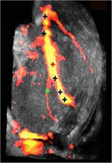 Fig. 9