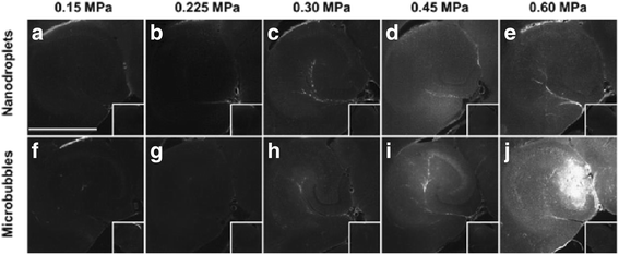 Fig. 11