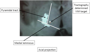 Fig. 1 (abstract A3).