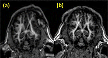 Fig. 23 (abstract A22).