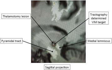 Fig. 2 (abstract A3).