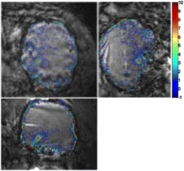 Fig. 9 (abstract A13).