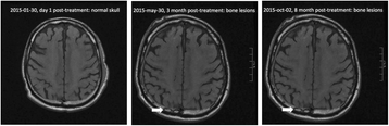 Fig. 17 (abstract O24).