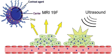 Fig. 185 (abstract P46).
