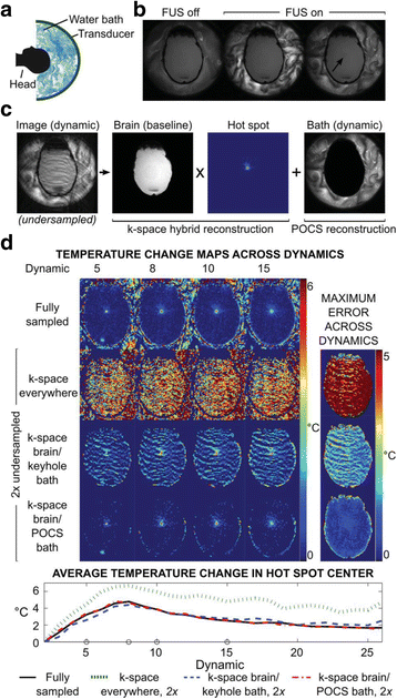 Fig. 30 (abstract O33).