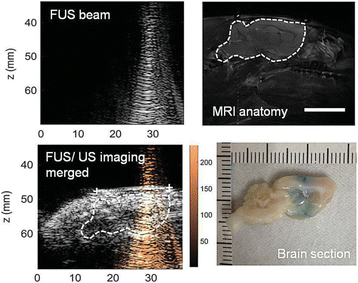 Fig. 47 (abstract O41).