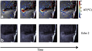 Fig. 51 (abstract O43).