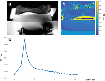 Fig. 53 (abstract O44).