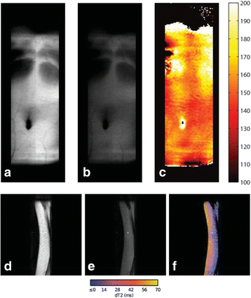 Fig. 56 (abstract O46).