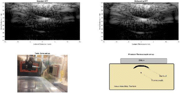 Fig. 1 (abstract O83).