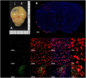 Fig. 1 (abstract P5).