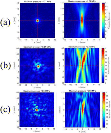 Fig. 1 (abstract P18).