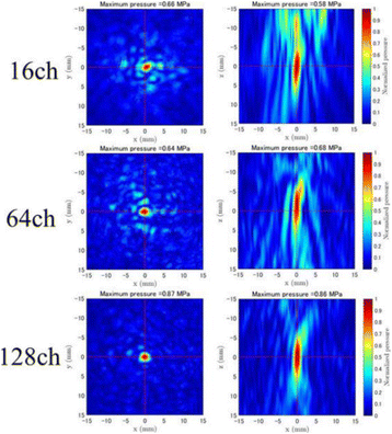 Fig. 2 (abstract P18).