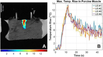 Fig. 1 (abstract P22).