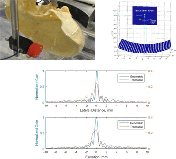 Fig. 1 (abstract P35).