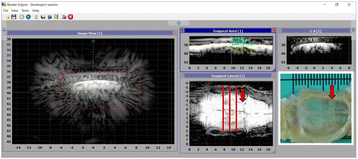 Fig. 2 (abstract P36).