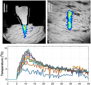 Fig. 1 (abstract P72).