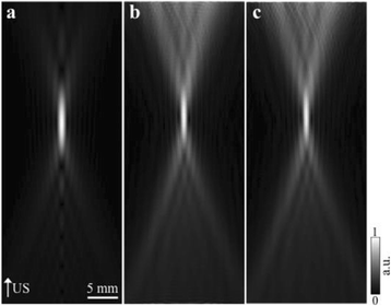 Fig. 1 (abstract O20).