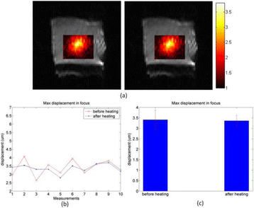 Fig. 1 (abstract O37).