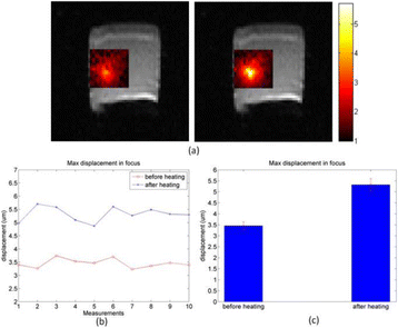 Fig. 2 (abstract O37).