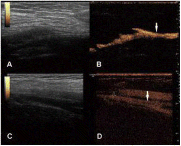 Fig. 3 (abstract O49).