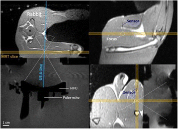 Fig. 1 (abstract O61).