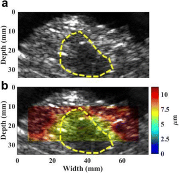 Fig. 1 (abstract O63).