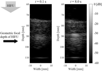 Fig. 4 (abstract O64).