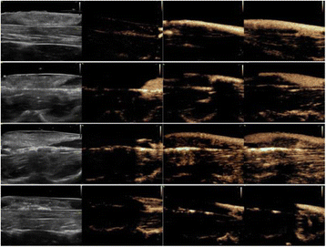 Fig. 1 (abstract O71).