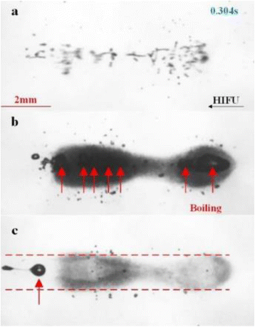 Fig. 1 (abstract O74).