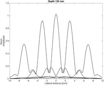 Fig. 3 (abstract O76).