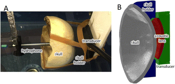 Fig. 1 (abstract O81).