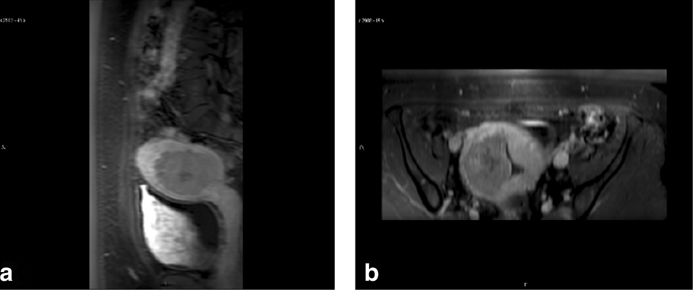 Fig. 10