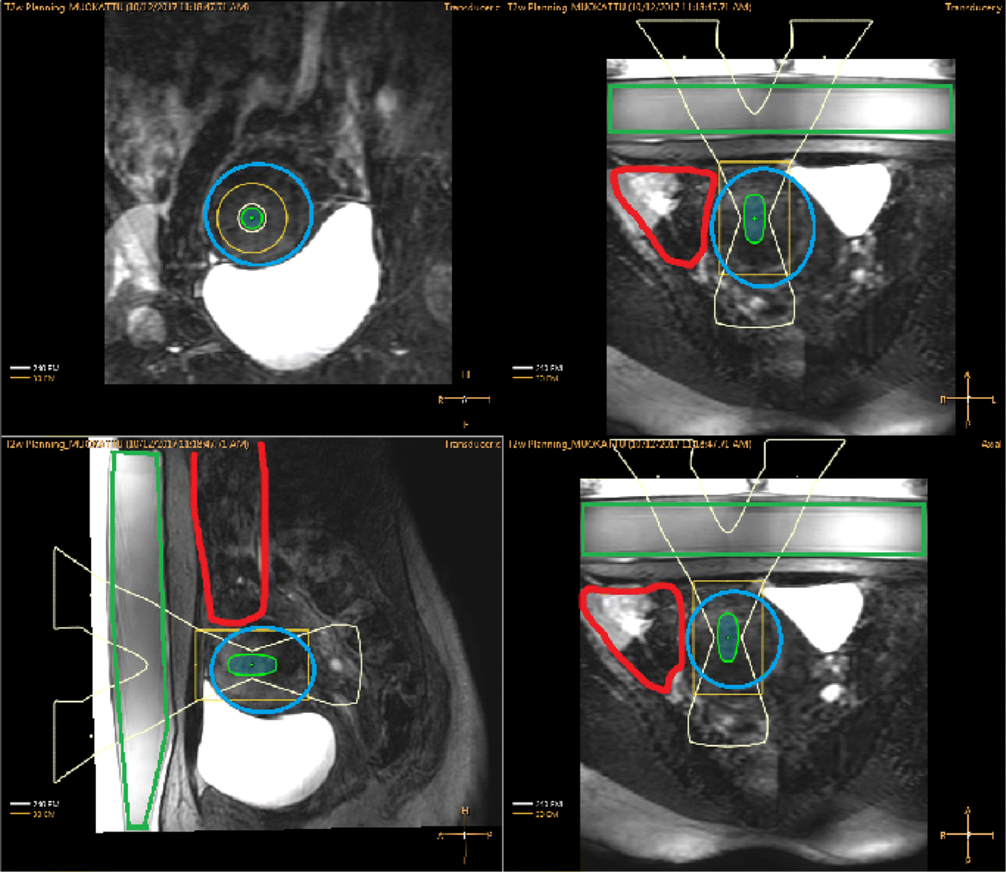 Fig. 5