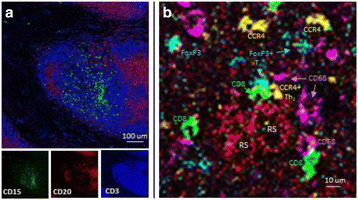 Fig. 2 (abstract P489)