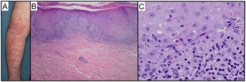 Fig. 3 (abstract P523).