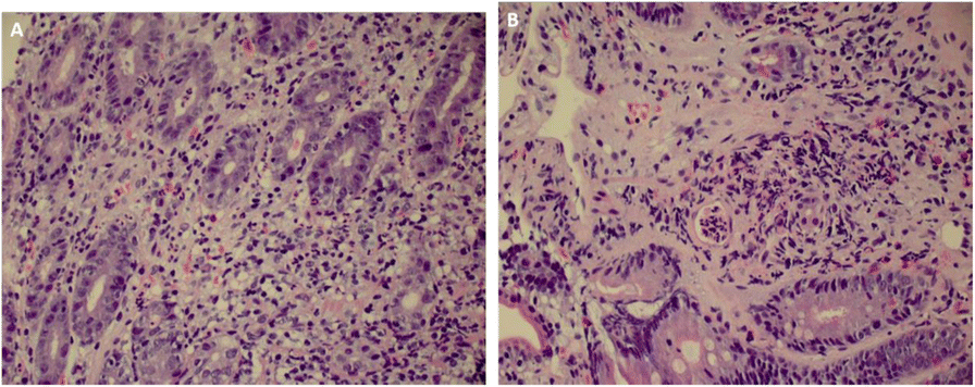 Fig. 1 (abstract P192).