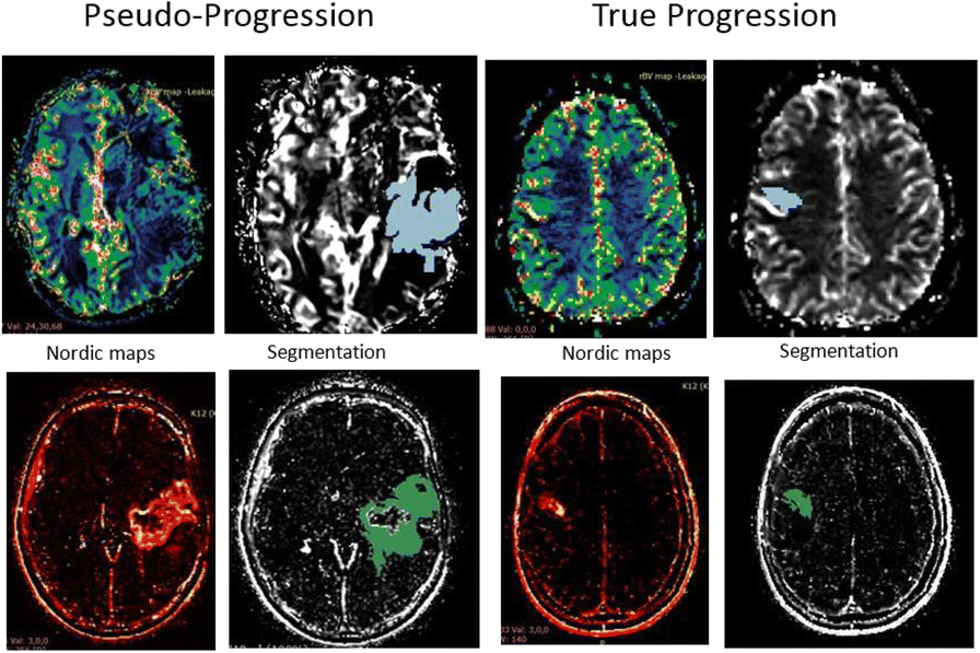 Fig. 1 (abstract P430).