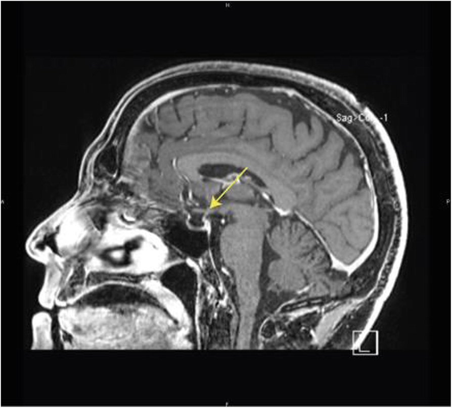 Fig. 1 (abstract P717).