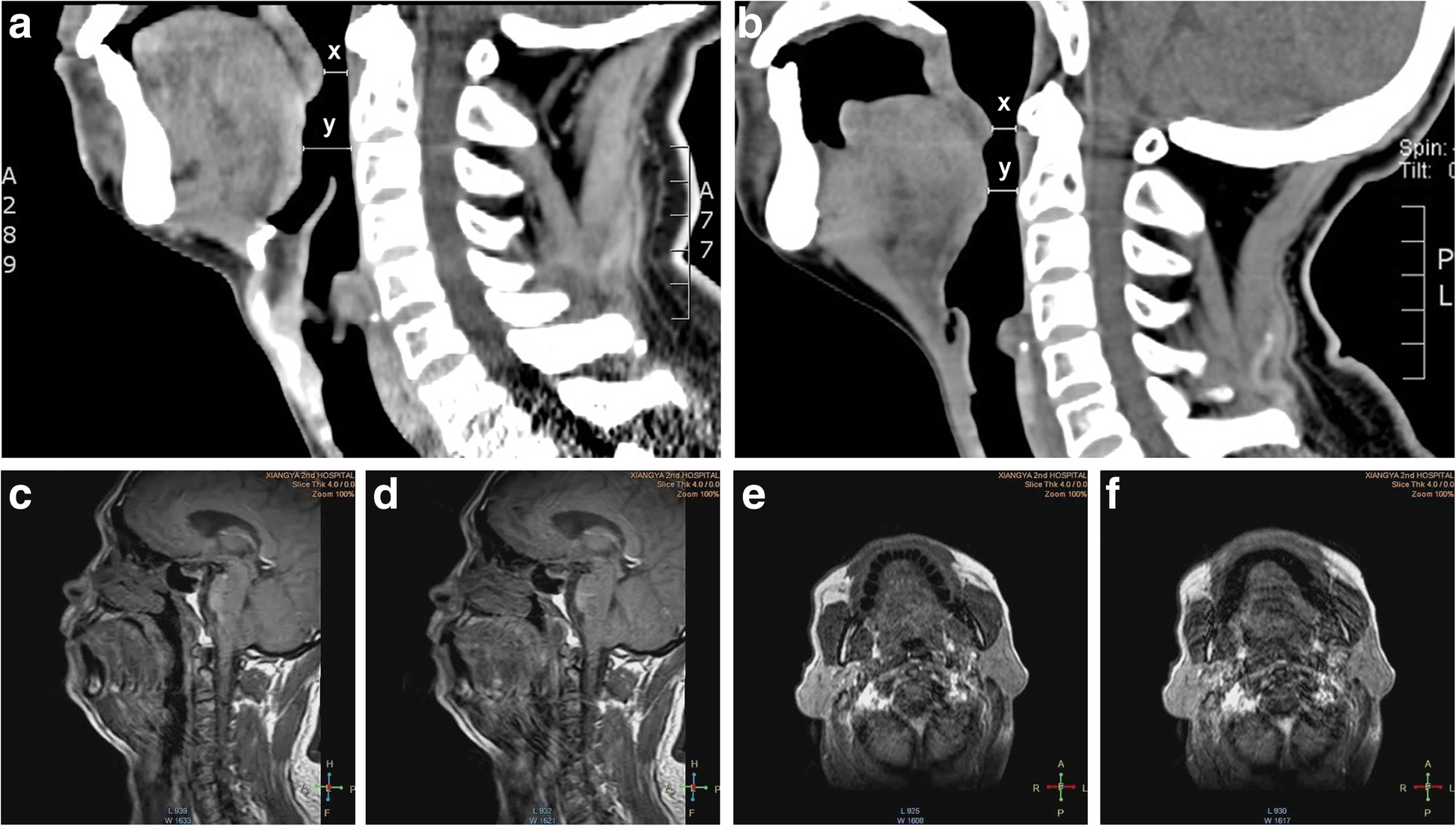 Fig 3.