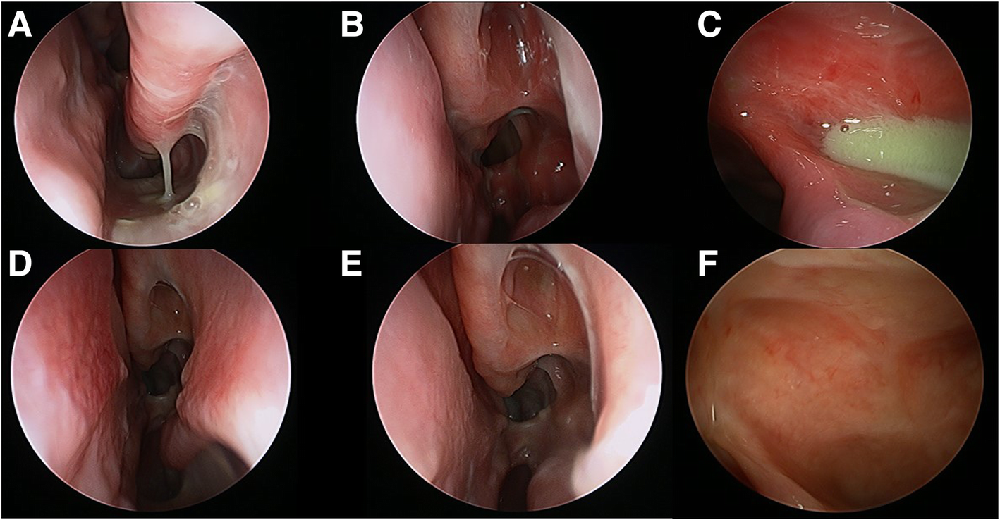 Fig. 6