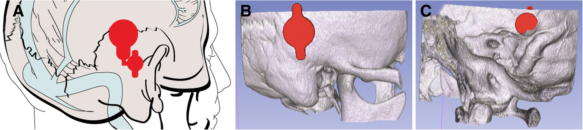 Fig. 5